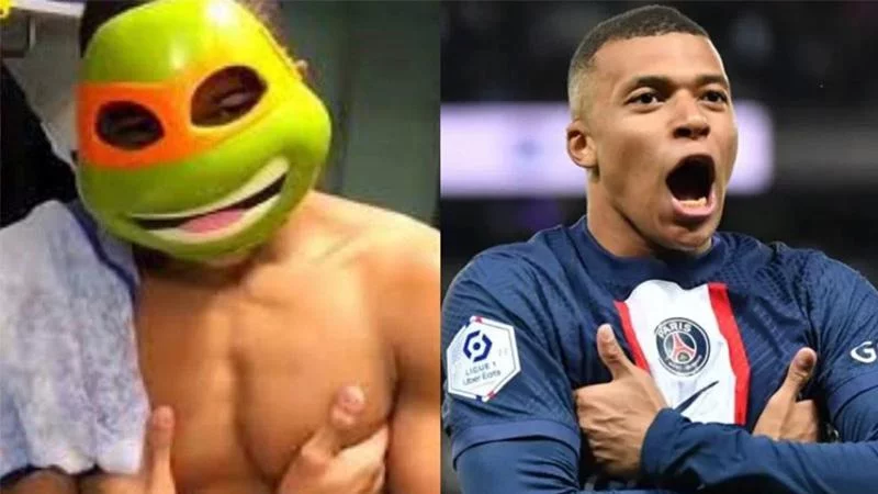 mbappe-bi-gay-mui-phai-deo-mat-na-bao-ve